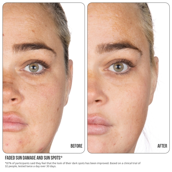 NIP FAB Vitaminc C Fix Tonic - Picture 6 of 6